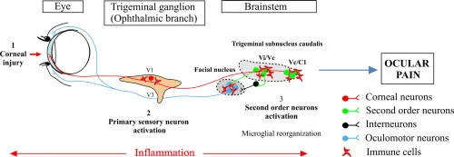 Ocular inflammation induces trigeminal pain, peripheral and central neuroinflammatory mechanisms